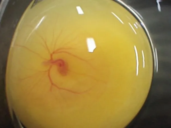 Внутренний вид оплодотворенной яйцеклетки